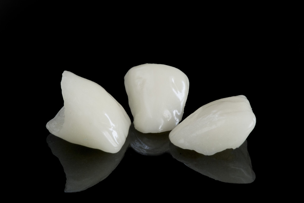 Three dental veneers on a black background