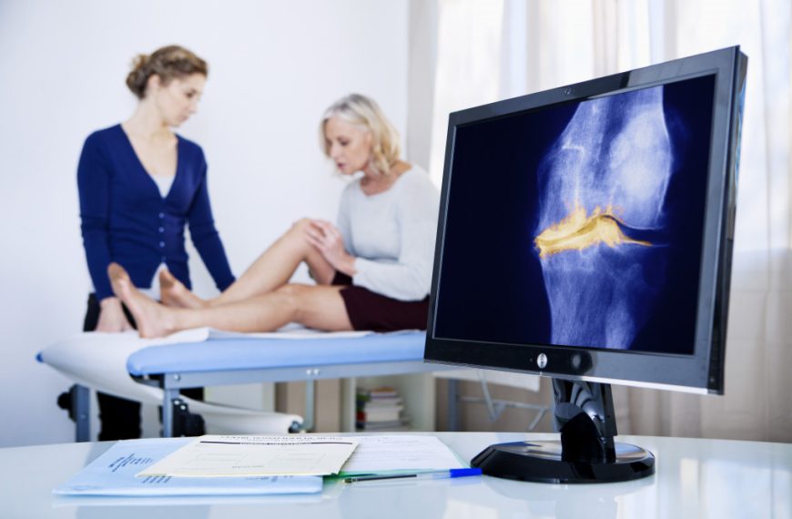 Osteoarthritis: Symptoms, Causes, and Treatment